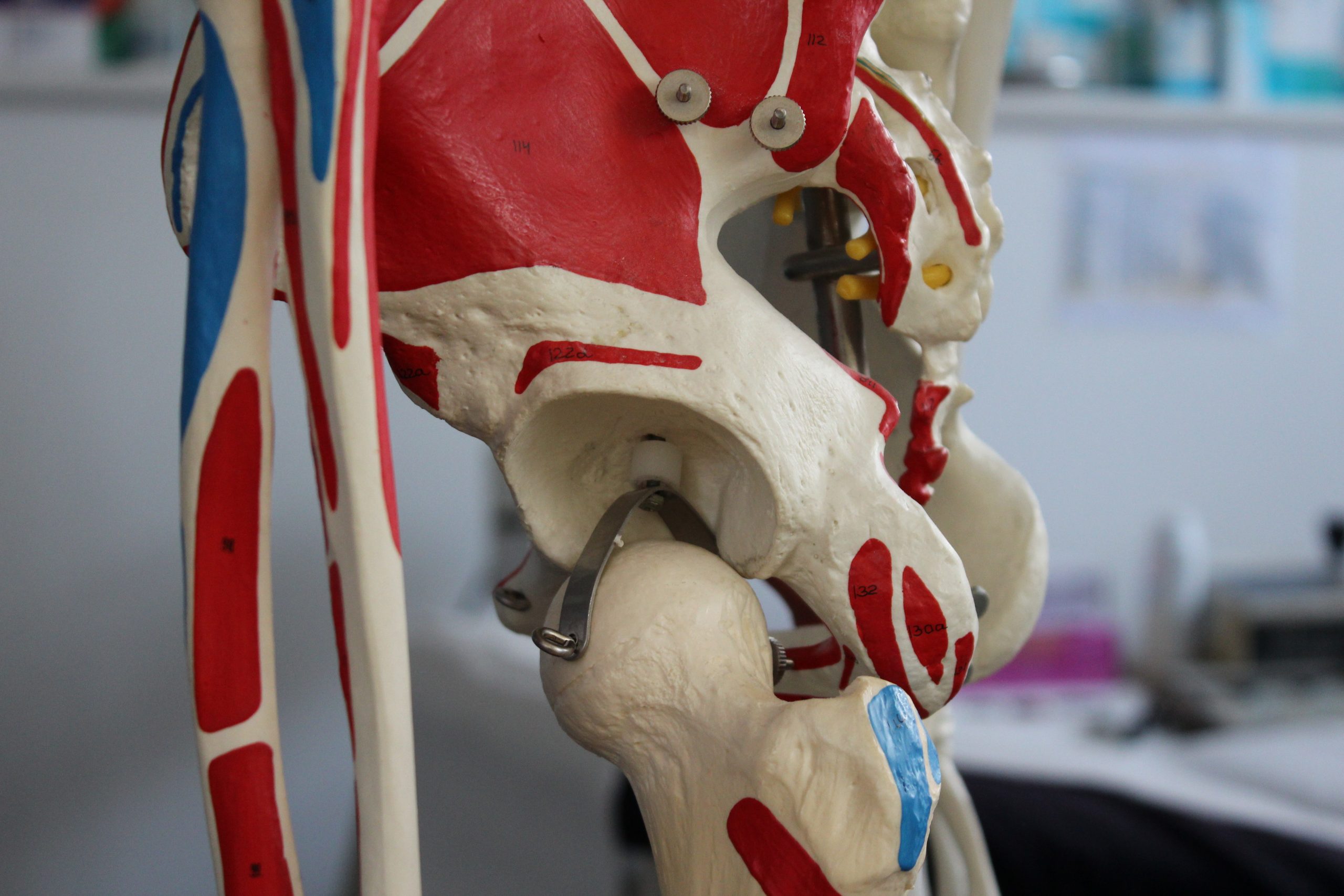 Hip Joint Pain
