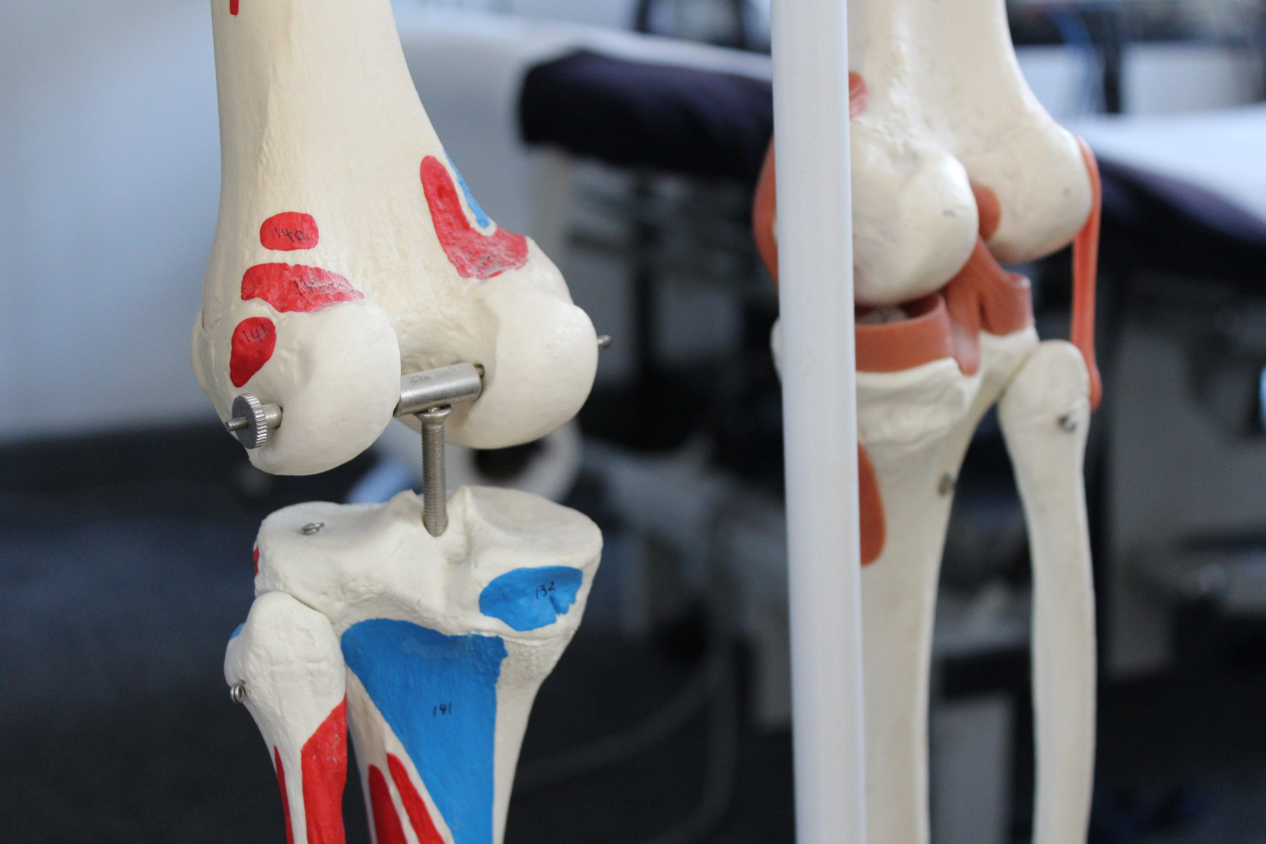 Osteolates Sports Therapy Knee Joint Pain