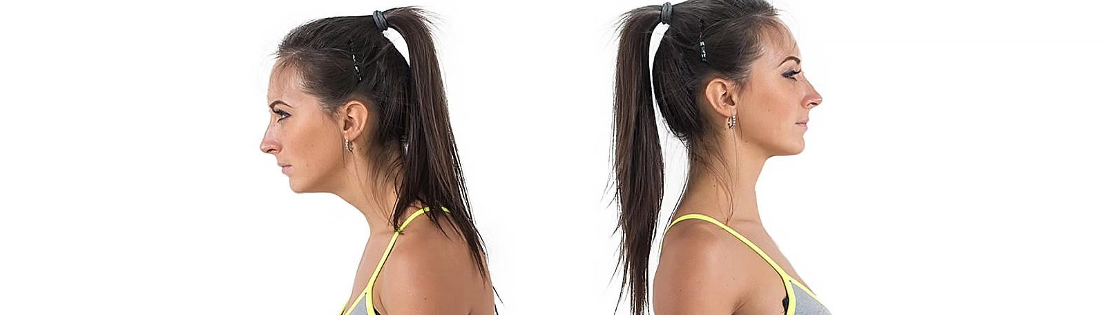 Side-profile comparison of upright posture against a forward head and rounded shoulder position